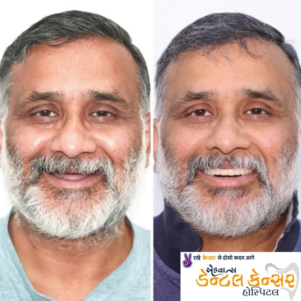 Home Client Results