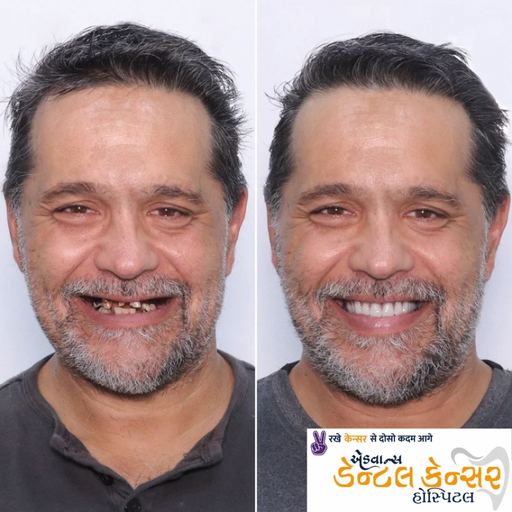Home Client Results
