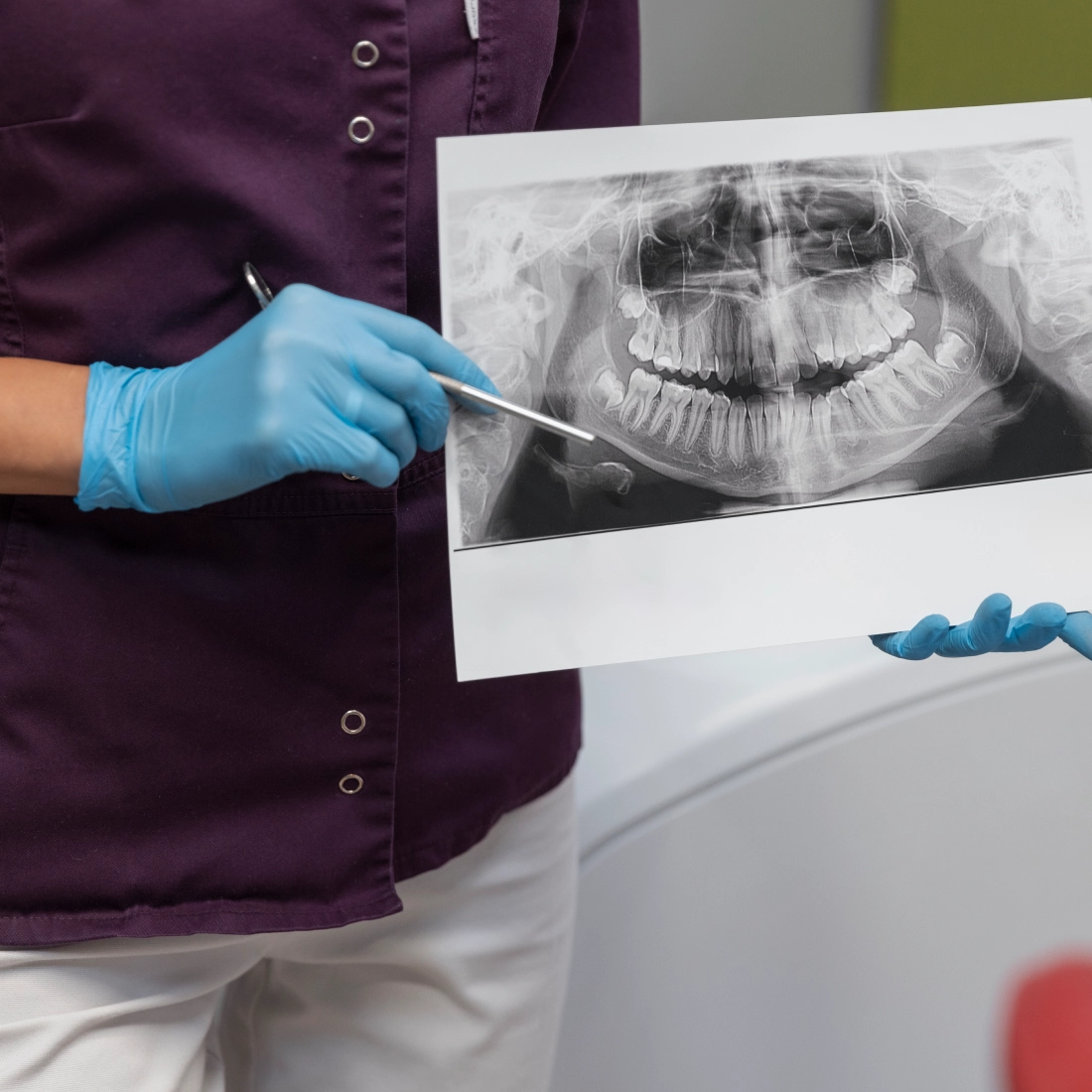 Home degital x ray